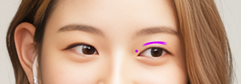 매끄러운 치아