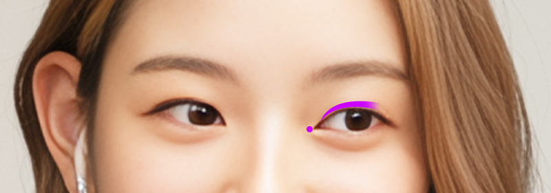 잇몸건강 효과