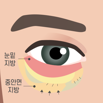 이미지명